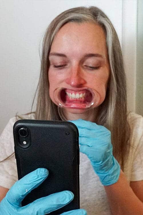 Byte Review — The 3Step Teeth Aligning Solution The Fascination Edit